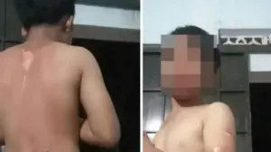 Công an xã Ea Đrăng xác minh vụ bé trai ở Đắk Lắk nghi bị mẹ tạt nước sôi gây bỏng, thu hút sự quan tâm của dư luận.
