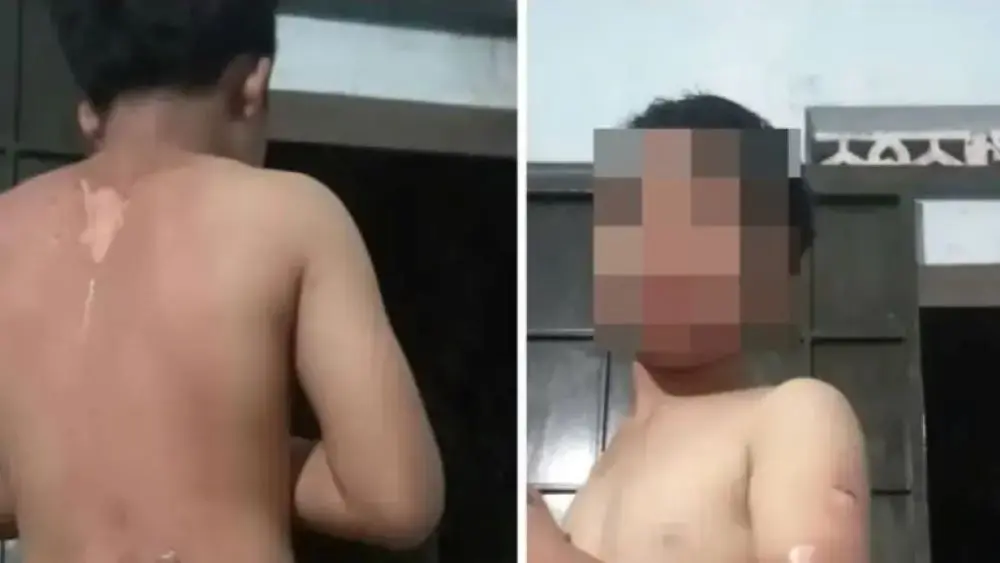 Công an xã Ea Đrăng xác minh vụ bé trai ở Đắk Lắk nghi bị mẹ tạt nước sôi gây bỏng, thu hút sự quan tâm của dư luận.