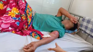 Người đàn ông ở Thanh Hóa mắc bệnh giun rồng sau khi uống nước suối. Tìm hiểu thông tin về ca bệnh và nguy cơ nhiễm ký sinh trùng.