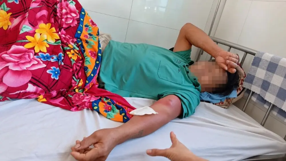 Người đàn ông ở Thanh Hóa mắc bệnh giun rồng sau khi uống nước suối. Tìm hiểu thông tin về ca bệnh và nguy cơ nhiễm ký sinh trùng.